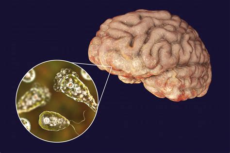  Naegleria: Een Kleine Veereter Die Door Uw Hersenen Kruipt! Naegleria fowleri, een microscopisch organisme behorend tot de Amoebozoa-groep, is een fascinerend voorbeeld van hoe de natuur soms schijnbaar tegenstrijdige eigenschappen verenigt.