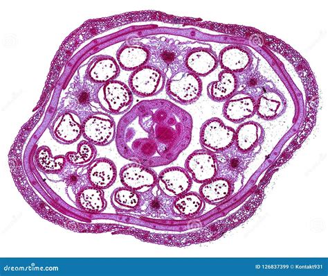  Tentamoeba: Ontdek de wonderen van een Amoebozoa met microscopische tentakels!